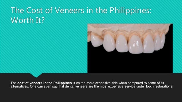 How to say you are my best friend in french How much do veneers cost per tooth in philippines